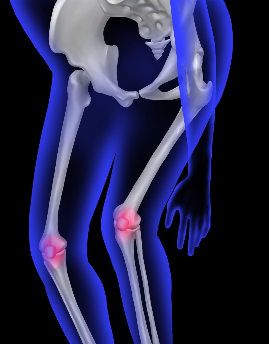 Condromalacia dolor de rodilla artrosis de rodilla ejercicios dolor de rodilla fisioterapia dolor de rodilla ejercicios dolor rodilla tratamiento dolor rodilla