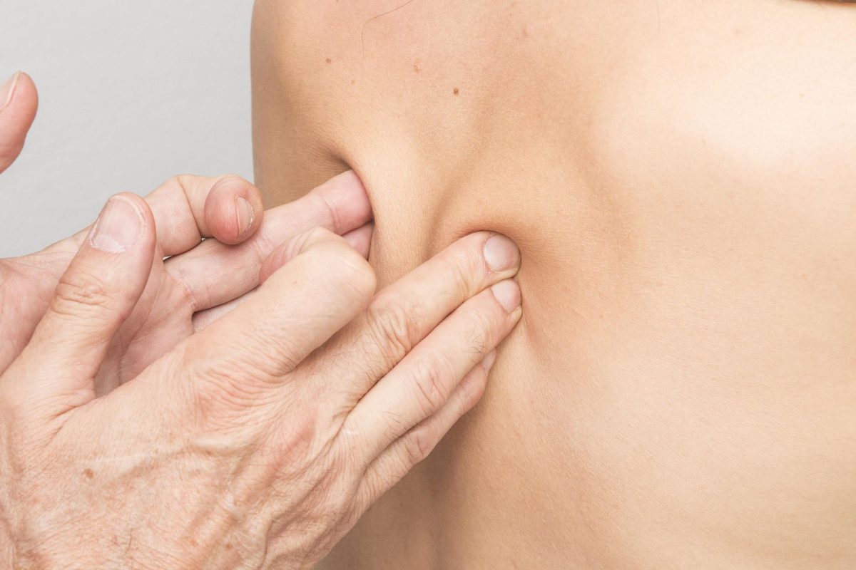 Presoterapia