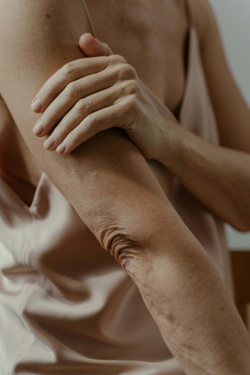 EPICONDILITIS O CODO DE TENISTA fisioterapia EPICONDILITIS O CODO DE TENISTA tratamiento EPICONDILITIS O CODO DE TENISTA ejercicios EPICONDILITIS O CODO DE TENISTA