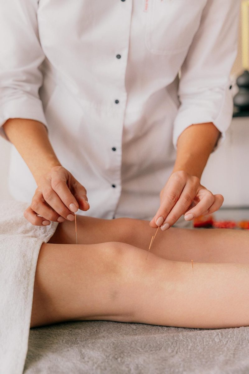 tendinopatia rotuliana fisioterapia tendinopatia rotuliana tratamiento tendinopatia rotuliana ejercicios tendinopatia rotuliana