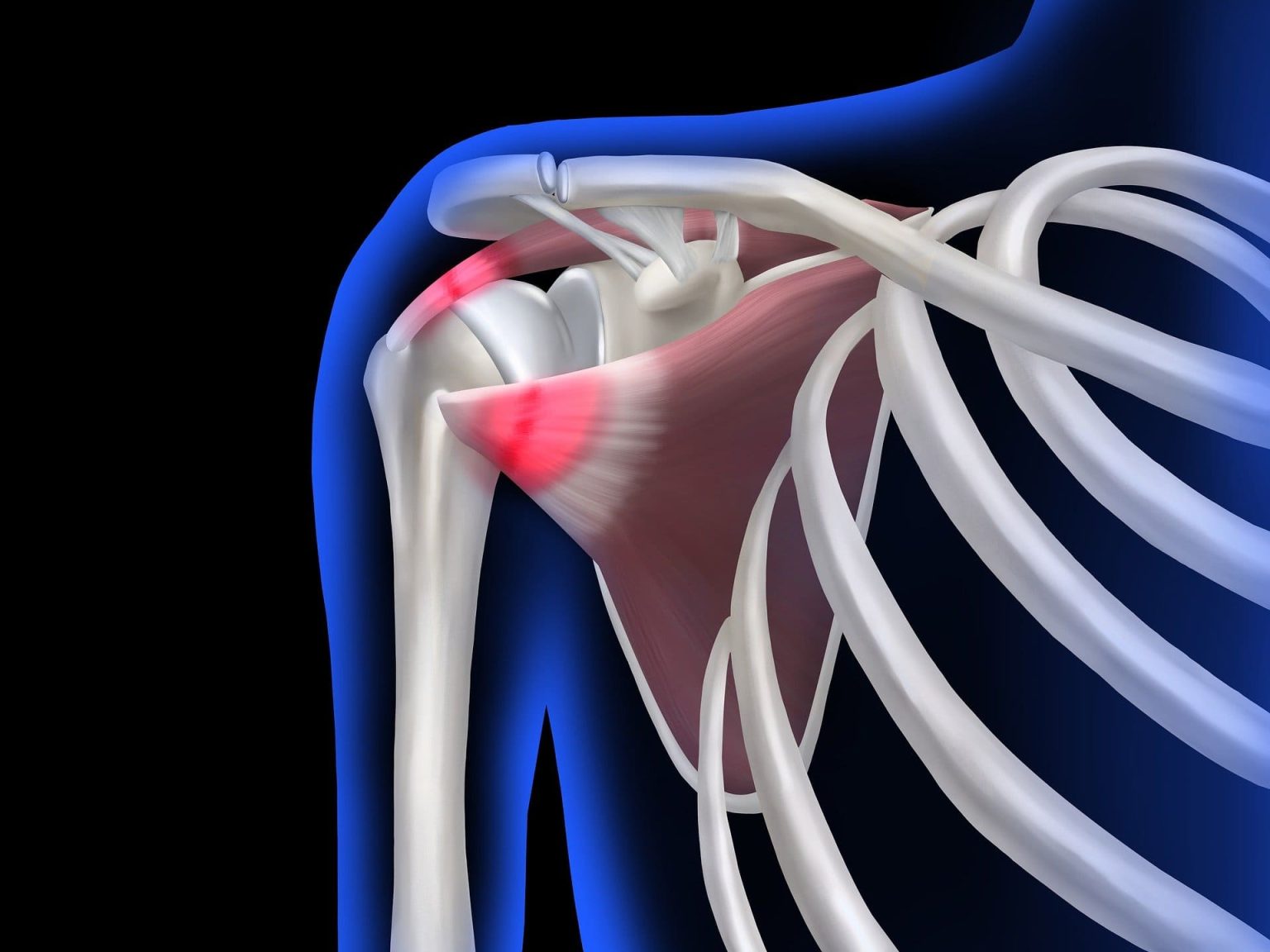 hombro congelado fisioterapia hombro congelado tratamiento hombro congelado capsulitis adhesiva